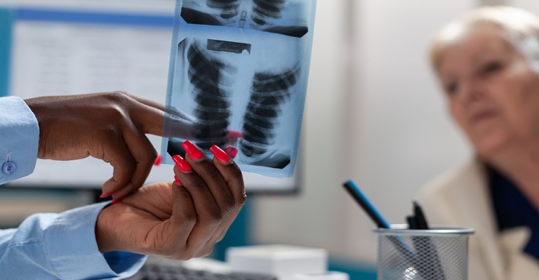 Pneumonia em idosos: sinais atípicos requerem atenção